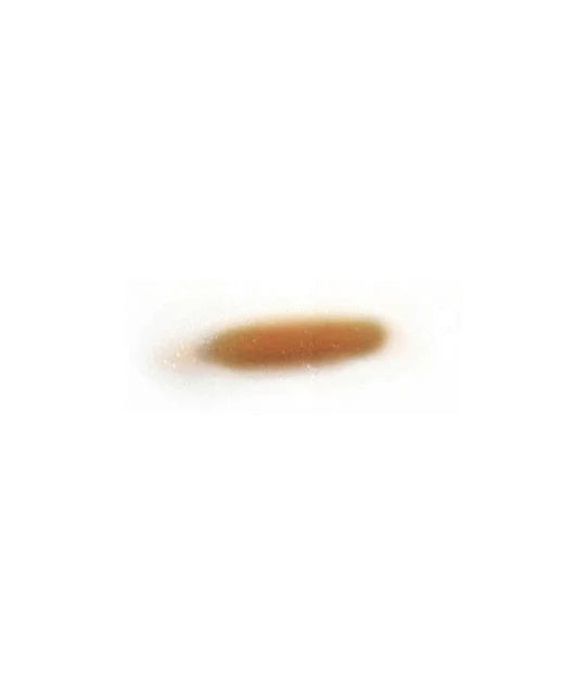 Out Of Kit Swollen Upper Eye Lid 1