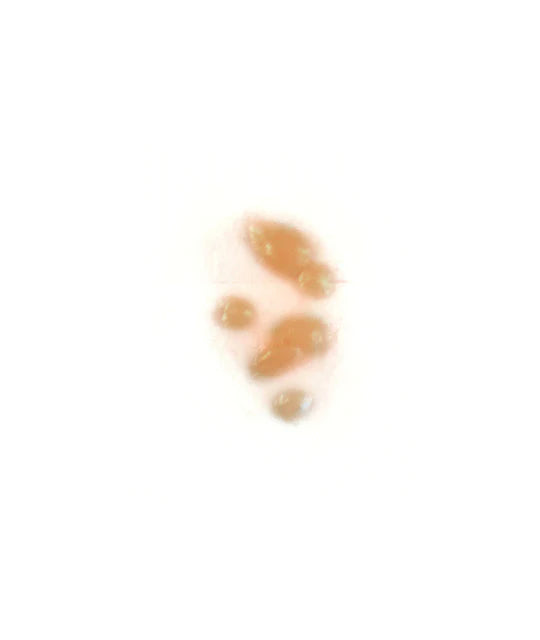 Out Of Kit Poison Ivy (Small)