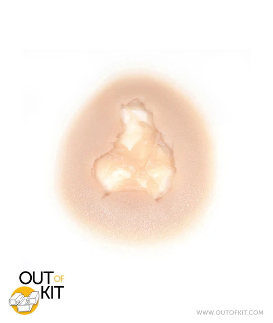 Out of Kit Exit Wound (MEDIUM)