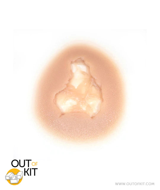 Out of Kit Exit Wound (MEDIUM)