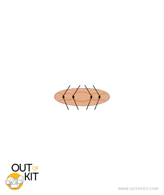 Out of Kit Micro Suture 4 Stitch