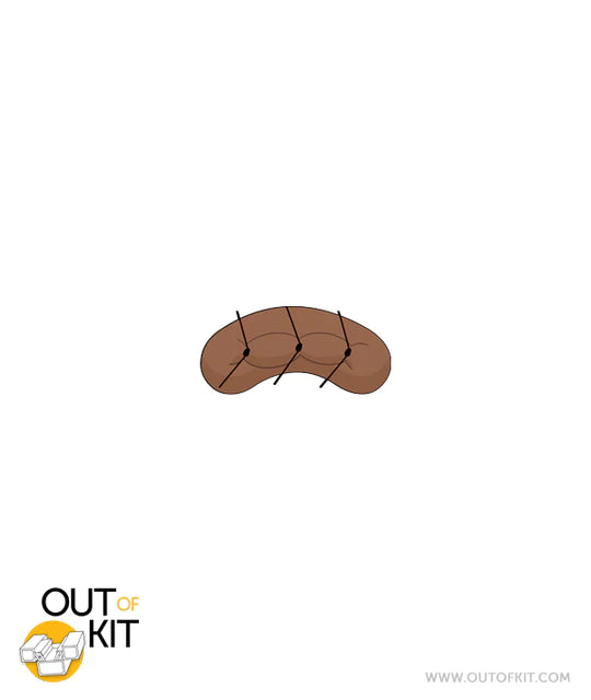 Out of Kit Micro Suture 3 Stitch