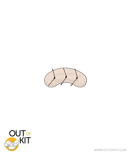 Out of Kit Micro Suture 3 Stitch