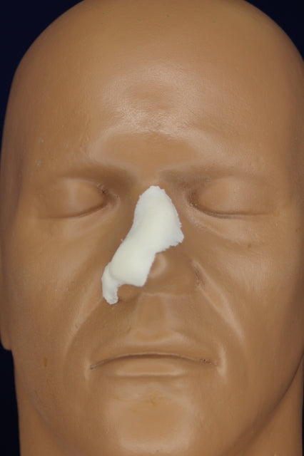 Small Broken Nose Insert