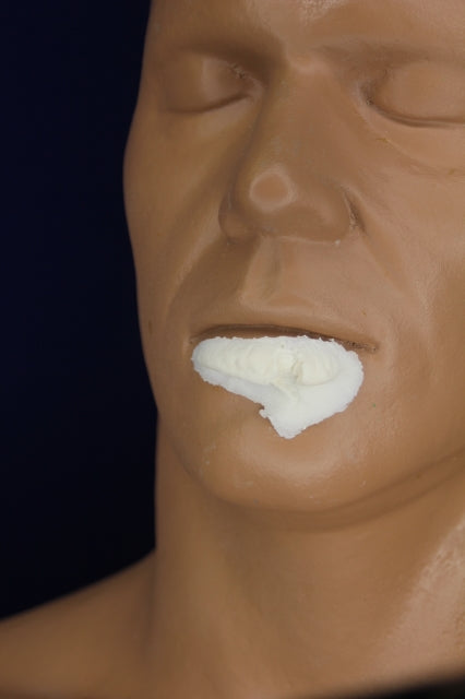 Large Split Lip Insert