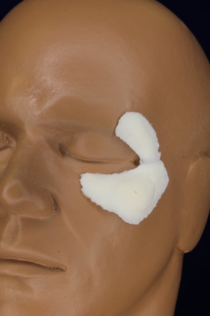 Left Swollen Cheek Insert
