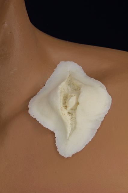 Deep Bone Gash Insert
