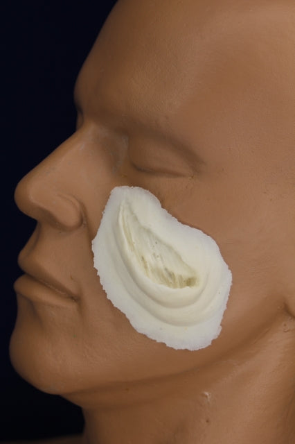 Large Skin Gouge Insert