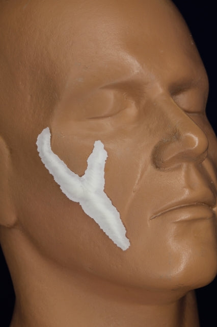 Y Scar Insert