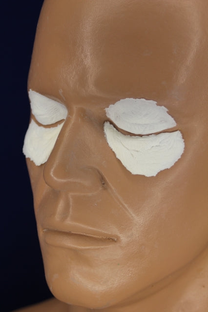 Aging Eyelids and Bags 2 Insert