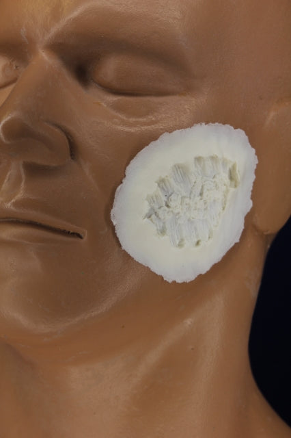 Bite Mark 2 Insert
