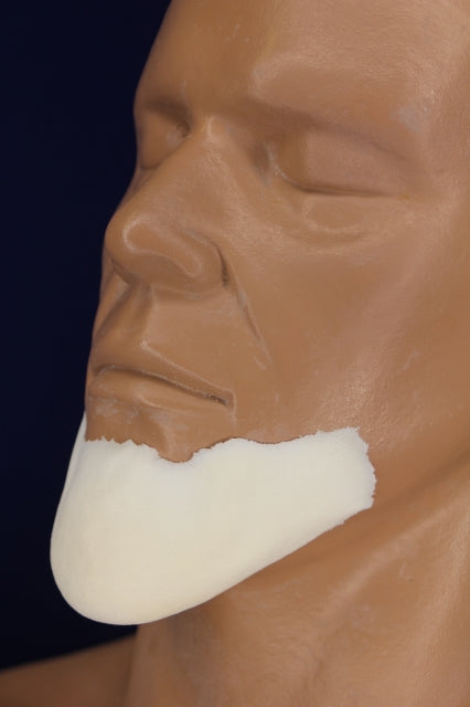 Elongated Chin Insert