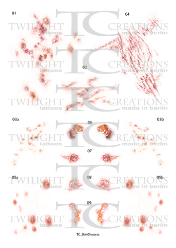 Twilight Creations Temp Tattoos Skin Disease