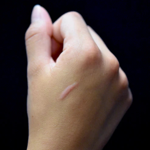 Out of Kit 3/4 Inch Scar