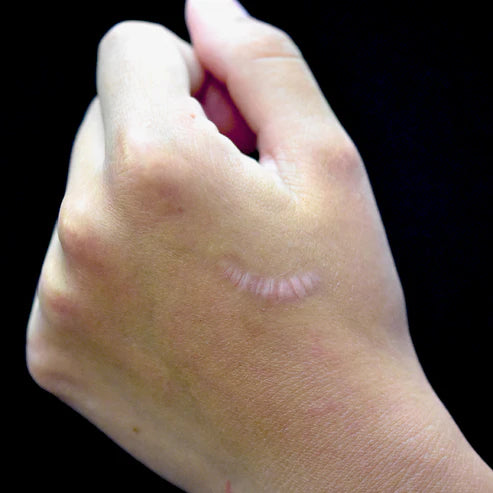 Out of Kit Wrinkled Scar
