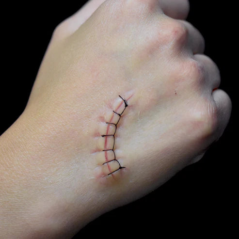 Out of Kit Locking Stitch Suture 2