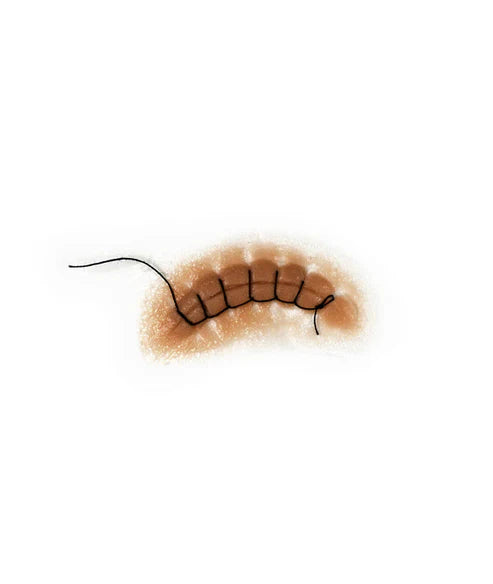 Out of Kit Locking Stitch Suture 2