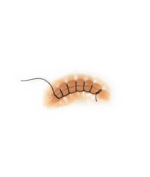 Out of Kit Locking Stitch Suture 2