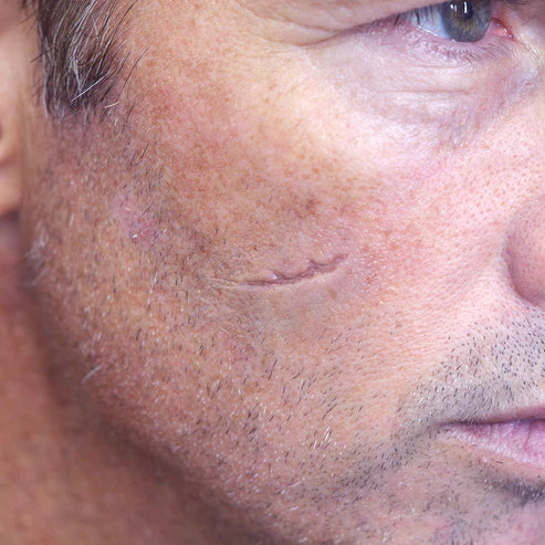 Out of Kit Sunken Scar 3