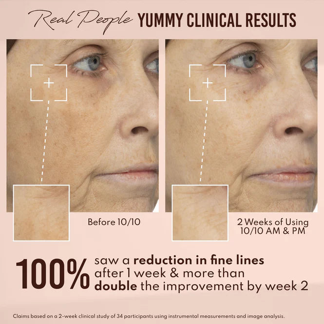 Danessa Myricks Beauty - Yummy Skin 10/10 barrier boost HA + Ectoin Serum 50ml