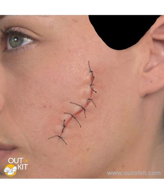Out of Kit Facial Suture Wound