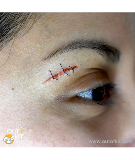 Out of Kit Micro Suture 3 Stitch
