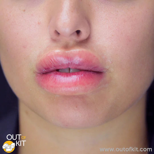 Out of Kit Swollen Lips