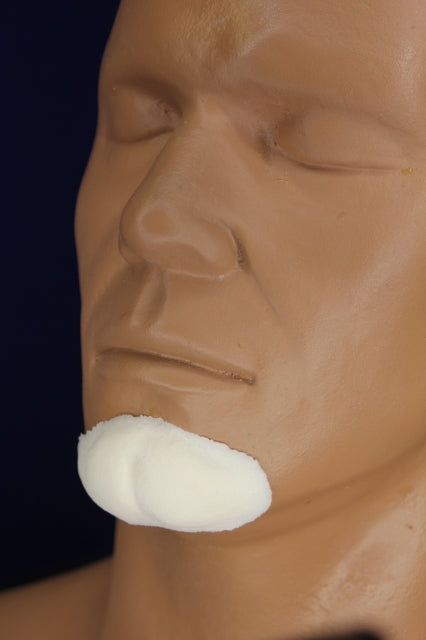 Large Cleft Chin Insert