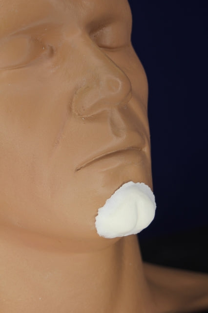 Small Cleft Chin Insert