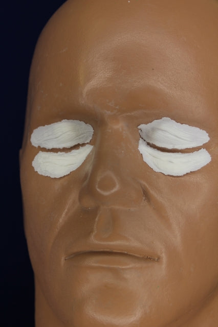 Aging Eyelids and Bags Insert