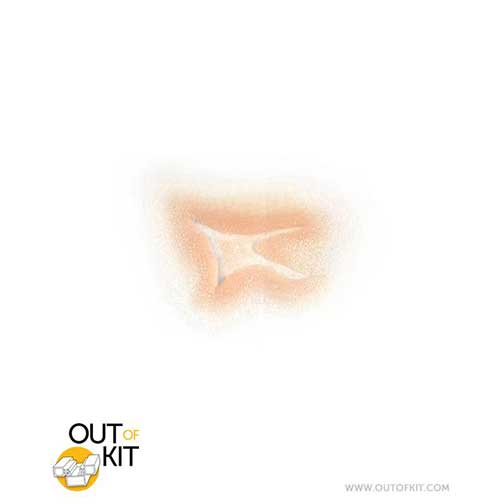 Out Of Kit Split Open Skin