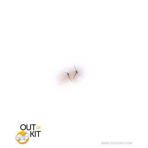 Out of Kit Sutured Wound 2 Stitch